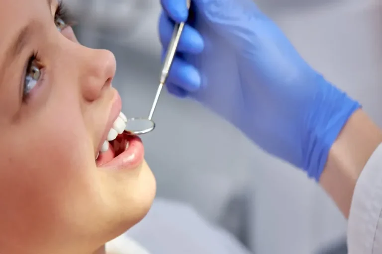 Dental Sealants